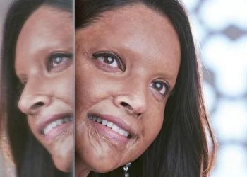 অ্যাসিডে আক্রান্ত দীপিকা, ট্রেলারেই বাজিমাত ‘ছাপাক’!